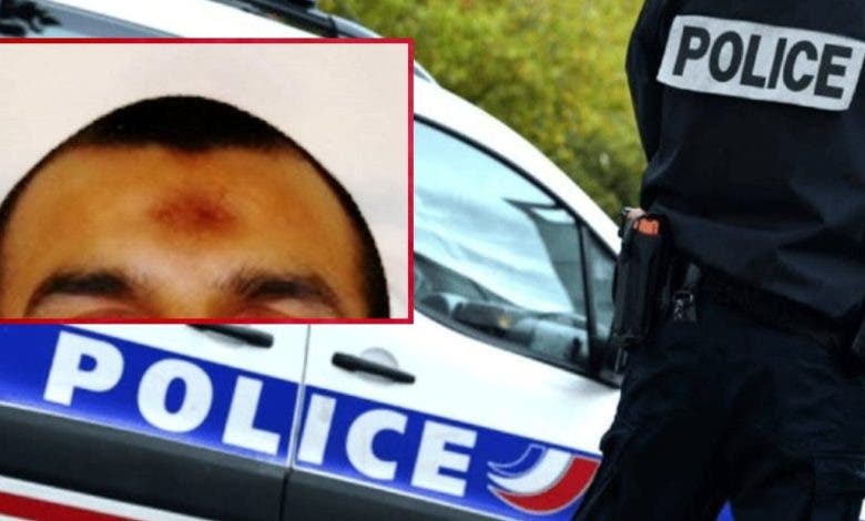 فرنسا.. علامة الصلاة على جبهة شاب تحرمه من ولوج سلك الشرطة